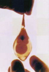 Beb&eacute; de seis semanas de gestaci&oacute;n